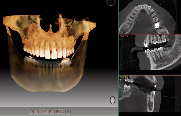 radiographie